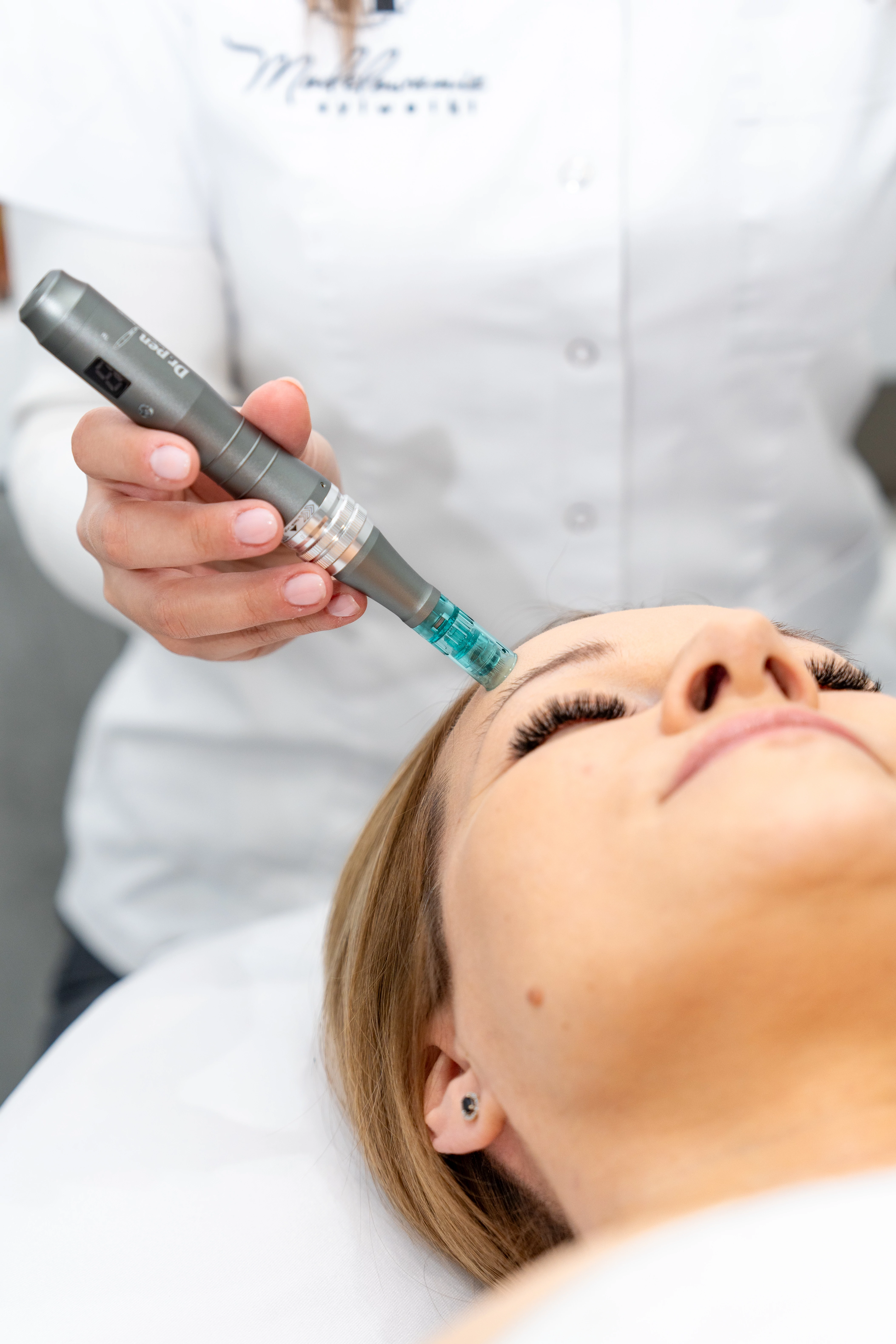 mezoterapia mikroiglowa zdjęcie